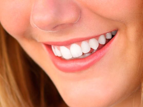 Clínica Dental El Zurguén sonrisa