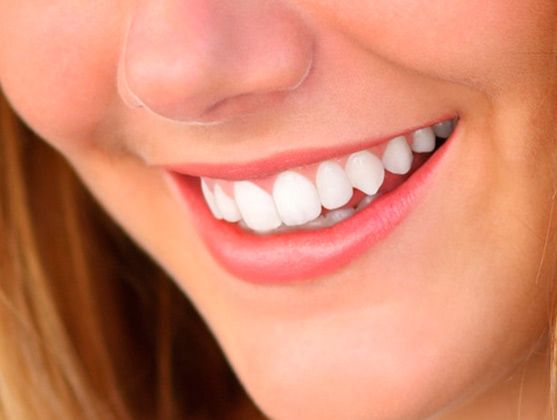 Clínica Dental El Zurguén sonrisa