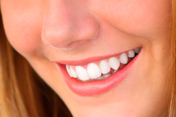 Clínica Dental El Zurguén sonrisa